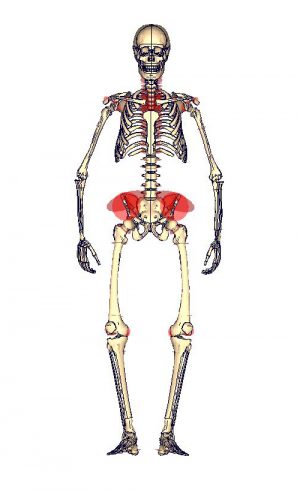 Injury Risk Analysis